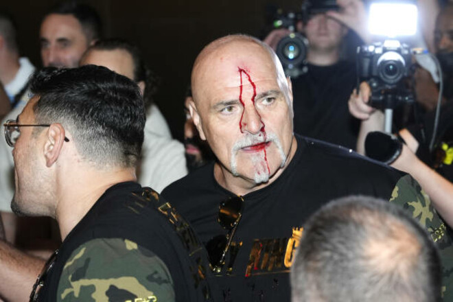 The fight between the teams of Usyk and Fury: John Fury broke his forehead